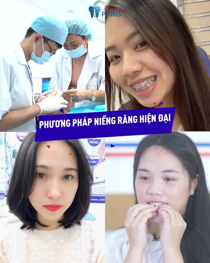 NIỀNG RĂNG CHO CON ĐÚNG THỜI ĐIỂM QUAN TRỌNG HAY RẤT QUAN TRỌNG