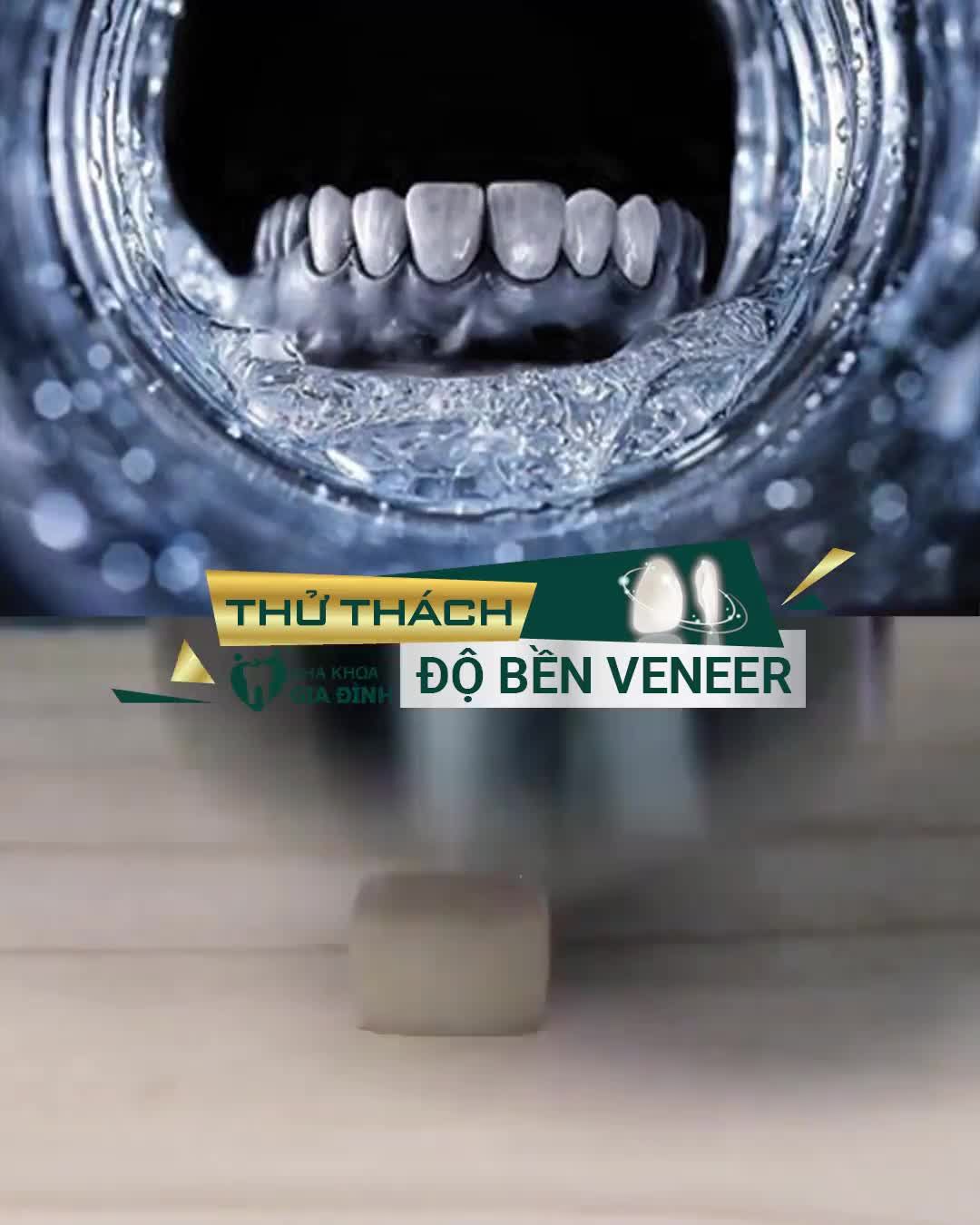 THỬ THÁCH ĐỘ BỀN CỦA VENEER SỨ