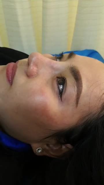 Nâng mũi bán cấu trúc Dáng SLine mềm mại Quá đẹp cho em gái Quận Bình Tân