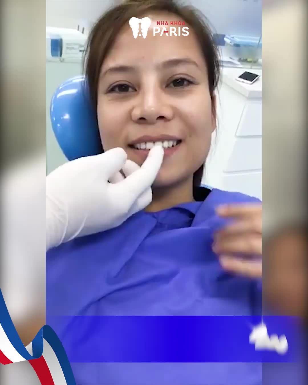 Bọc Răng Sứ Điều Trị Răng Thưa, Khấp Khểnh, Hô Nhẹ, Nhiễm Màu