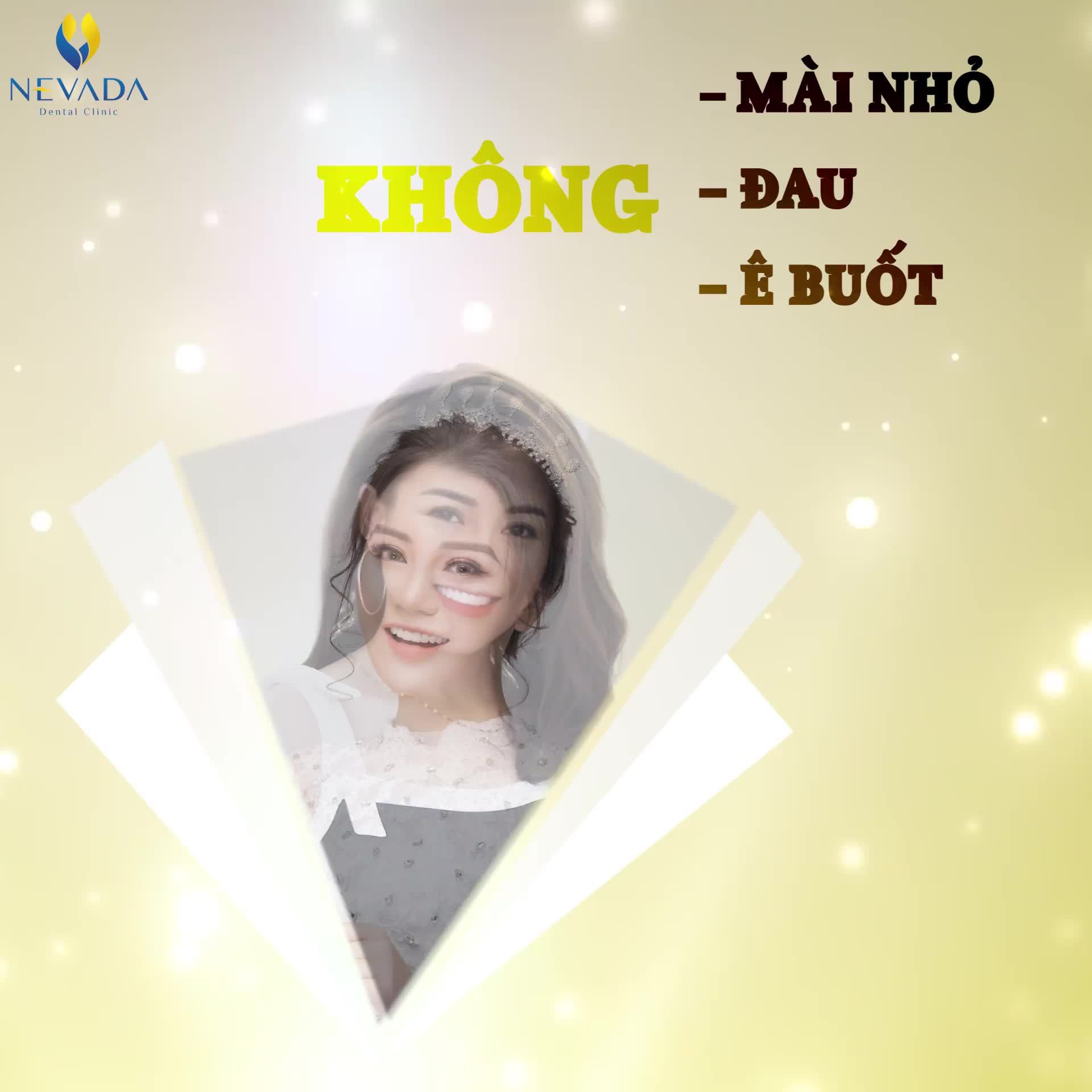 DÁN SỨ VENEER OFF 50%