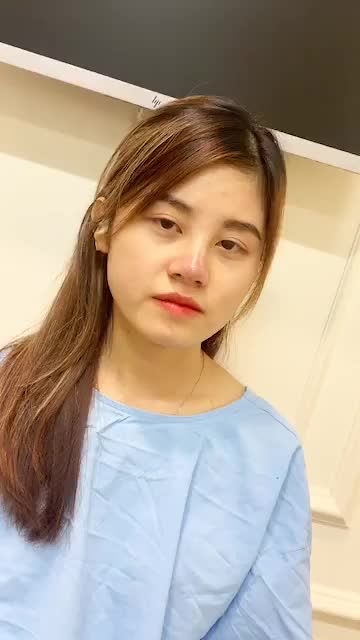 GÓC NGHIÊNG THẦN THÁI NGAY SAU KHI Nâng Mũi CẤU TRÚC SỤN SURGIFORM TẠI NAMSAN
