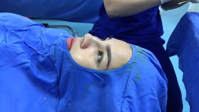 Kết quả ca mũi sửa cực khó của ekip Bác Sĩ trong ngày hôm nay