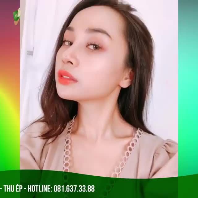 KHÁCH HÀNG NÂNG MŨI SLINE BỌC SỤN KẾT HỢP THU ÉP TẠI SÀI GÒN VENUS SAU 3 THÁNG