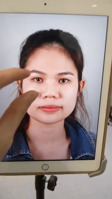 KHÁCH HÀNG VỪA THỰC HIỆN XONG CA NÂNG MŨI CẤU TRÚC DÁNG S-LINE CAO THON