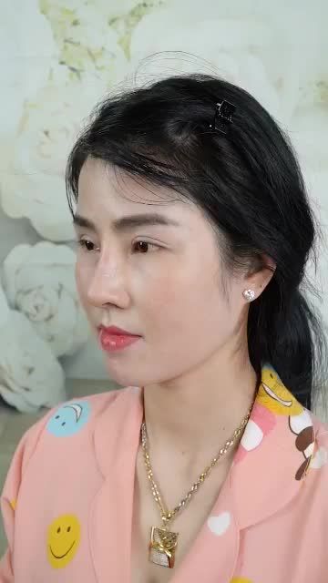 "MŨI EM TỪNG NÂNG NHƯNG BỊ HỎNG, EM ĐÃ ĐẾN DR.HOẠT ĐỂ SỬA LẠI - EM HÀI LÒNG VỚI DÁNG MŨI NÀY"