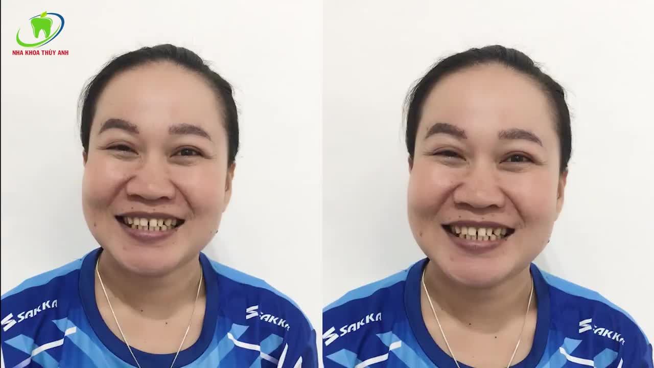 NỤ CƯỜI TƯƠI MỚI CHO CÔ BẠN TỚI TỪ LÀO