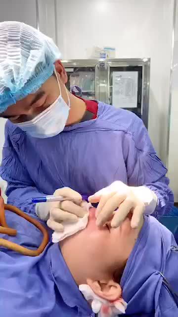 Phân tích phẫu thuật nâng mũi chỉnh xương phức tạp tại BVTM Kangnam