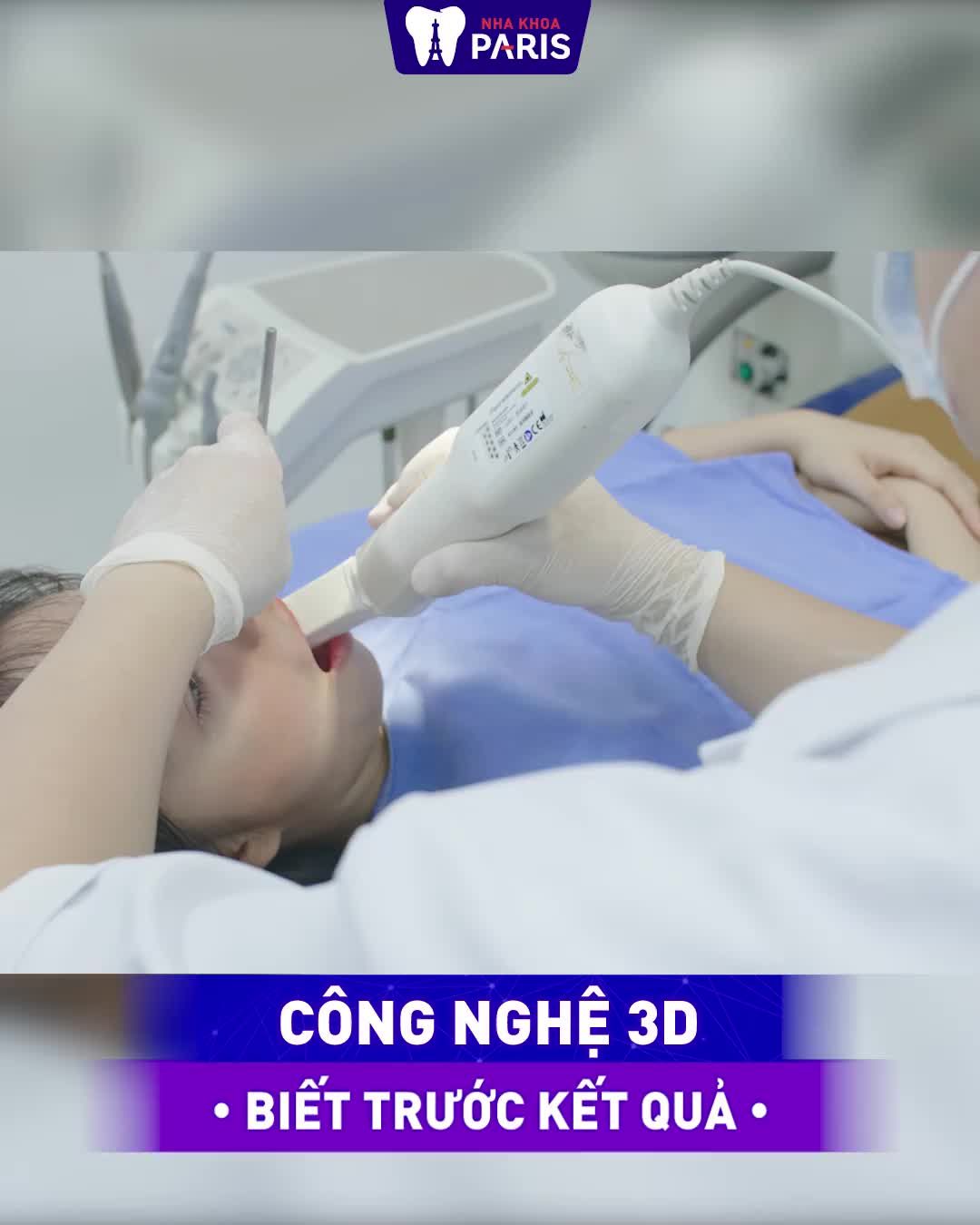 NIỀNG RĂNG THAY ĐỔI RĂNG LỆCH LẠC - RÚT NGẮN 6 THÁNG ĐEO NIỀNG