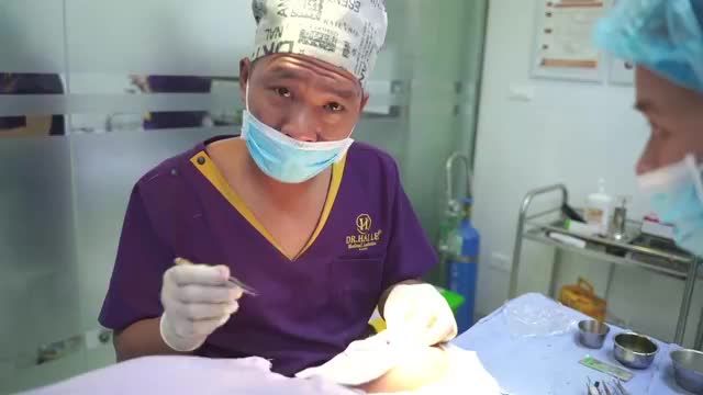 Sau 30 phút tại phòng phẫu thuât của Dr.Hải Lê, chiếc "mũi hỏng" của khách hàng đã được "giải cứu" thành công!