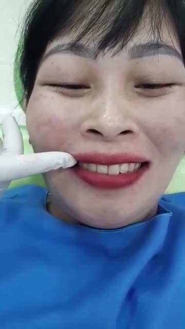 Tháo mắc cài cho chị Thảo!
