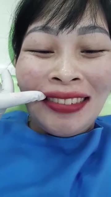 Tháo mắc cài cho chị Thảo!