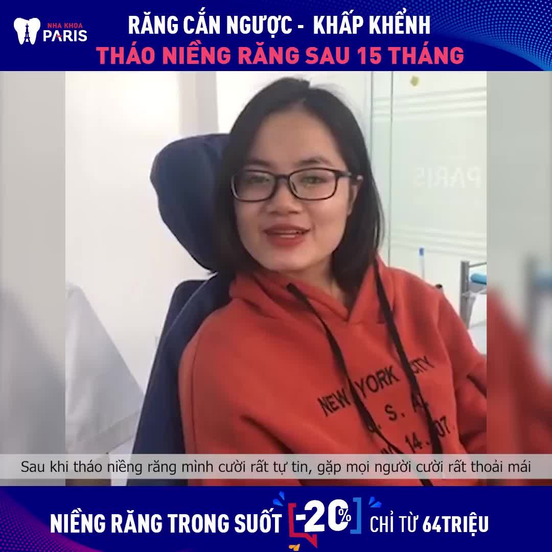 Cận cảnh kết quả sau quá trình 15 THÁNG NIỀNG RĂNG