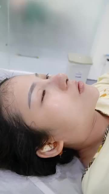 NHỮNG NGÀY CUỐI NĂM CŨ NHIỀU KHÁCH HÀNG TRANH THỦ NÂNG MŨI ĐỂ HOÀN THIỆN NHAN SẮC