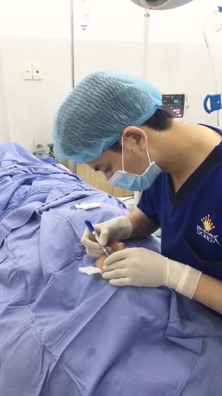 Cận cảnh BS sử dụng tia Laser loại bỏ da chùng cho khách hàng