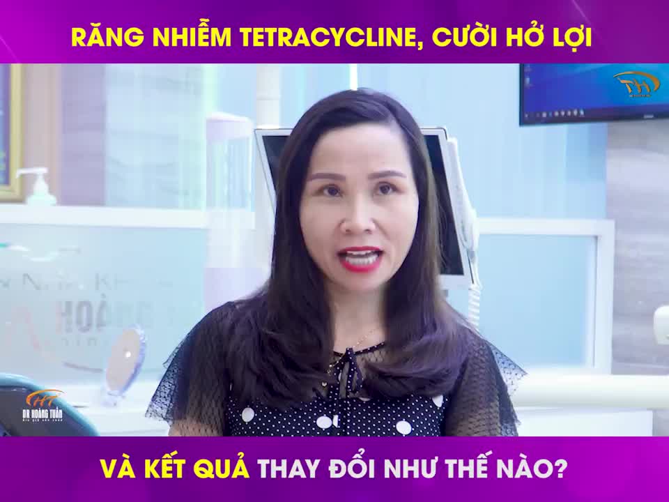 CHIA SẺ CỦA KHÁCH HÀNG RĂNG SỨ