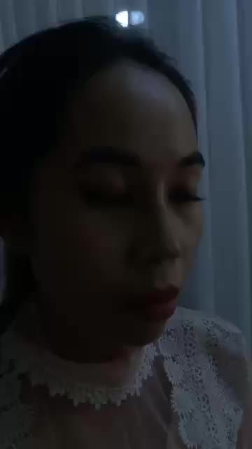 Nâng mũi bán cấu trúc đẹp hoàn hảo sau 16 ngày cùng Bác Sĩ Kỳ Y Dược