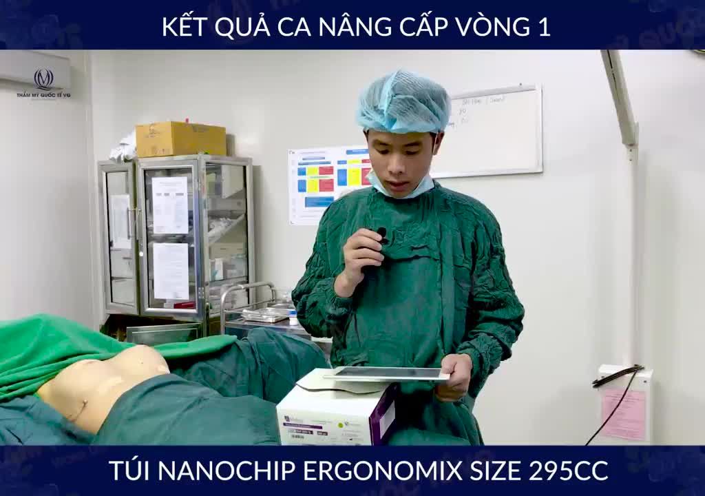 Kết quả nâng cấp vòng 1 túi Motiva NanoChip Ergonomix size 295cc cho chị khách hàng đã sinh 1 bé