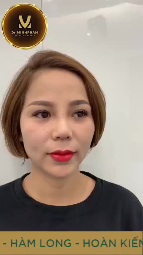 MŨI GỒ - MŨI GÃY GƯƠNG MẶT KHÔNG CÂN ĐỐI  PHONG THUỶ KHÔNG TỐT