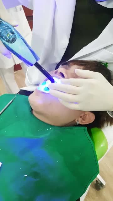Case dán 20 Veneer Emax - KH Đức Thông tại chi nhánh Nguyễn Ngọc Vũ.