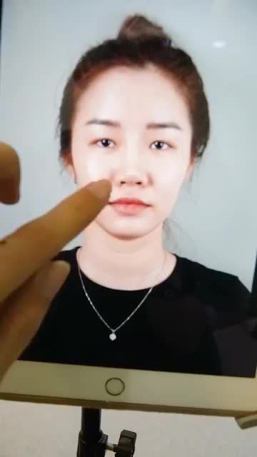 DR.HOẠT KHẮC PHỤC MỌI BIẾN CHỨNG SAU NÂNG MŨI HỎNG CHO KHÁCH