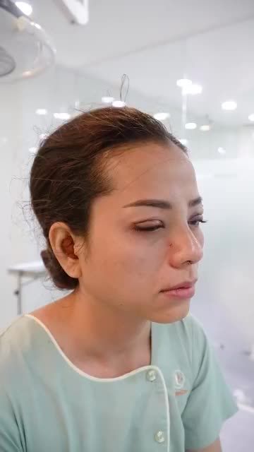 COMBO MŨI ĐẸP + MẮT TO TRÒN HAI MÍ