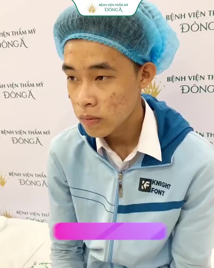 Mụn đeo bám dai dẳng Mụn đầu đen, mụn trứng cá, mụn ẩn, mụn viêm.