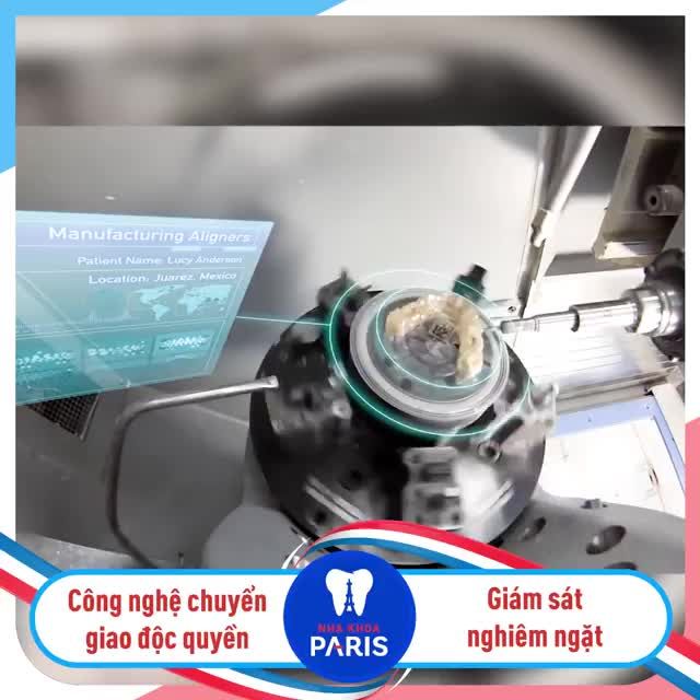 NIỀNG RĂNG 3D SPEED  Công nghệ hàng đầu chuyển giao độc quyền từ Châu Âu