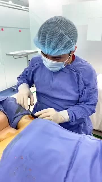 CHẤM DỨT 20 NĂM HÔI NÁCH NHỜ ENDO DRY