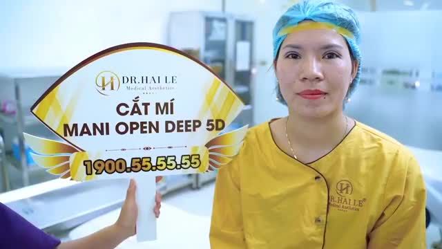 Sở hữu đôi mắt đẹp rạng ngời chỉ sau 30 phút với Cắt mí Mani Open Deep 5D!