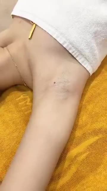 Triệt lông nách - Giá sốc giật mình - Chỉ 99K