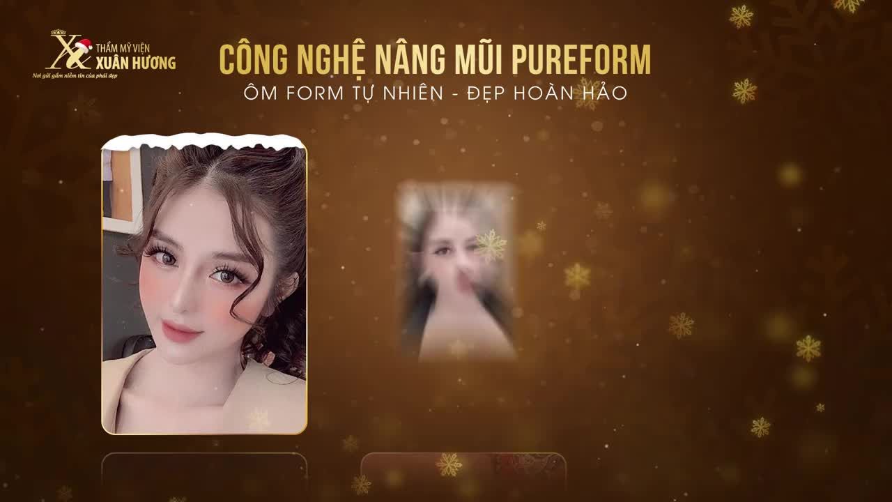 CAO TÙY CHỌN - SỬA TÙY Ý - ĐIỀU ĐẶC BIỆT DUY NHẤT CHỈ CÓ Ở NÂNG MŨI TẠI TMV XUÂN HƯƠNG!