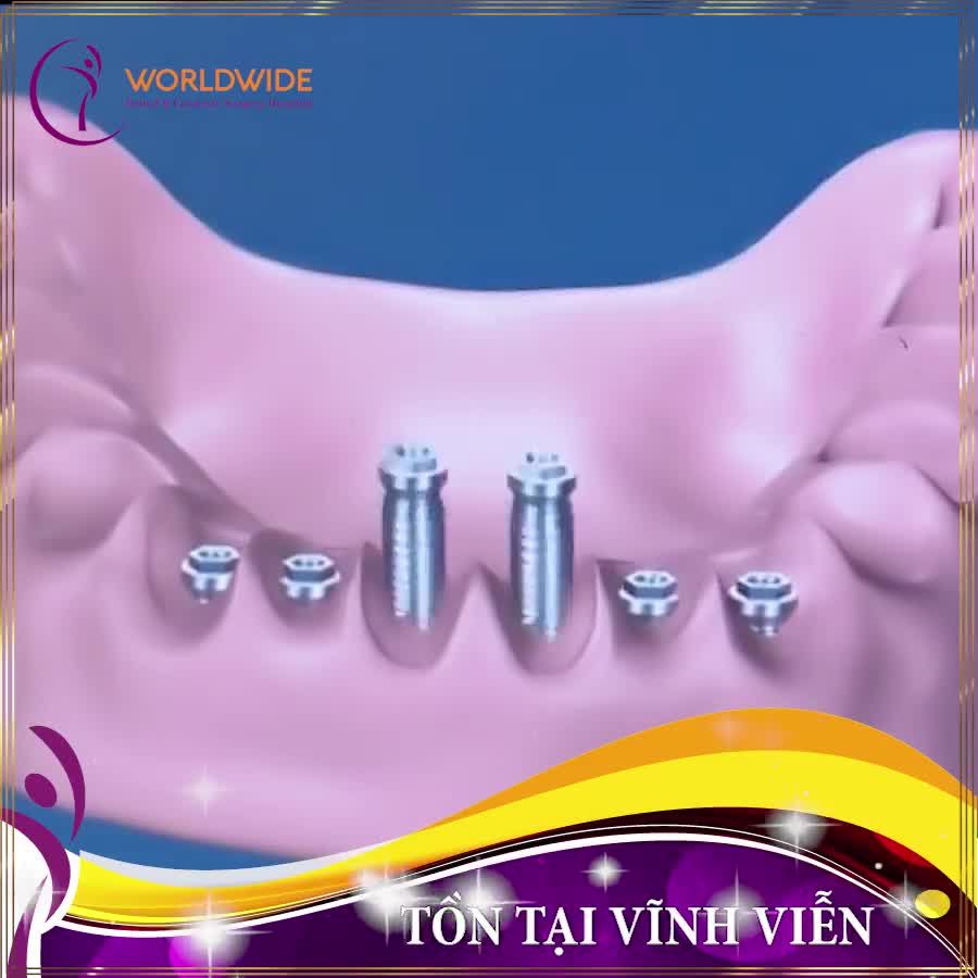 MẤT RĂNG THÌ ĂN TẾT CÒN VUI GÌ NỮA ..