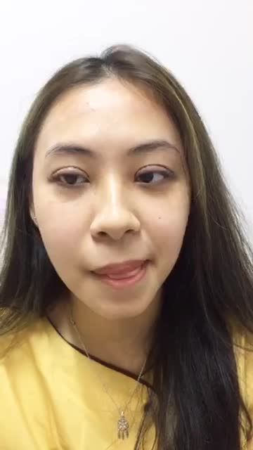 Bạn sinh viên ĐH Kinh tế Quốc Dân "không nhận ra mình" sau khi cắt mí Mani Open Deep 5D vừa xong!