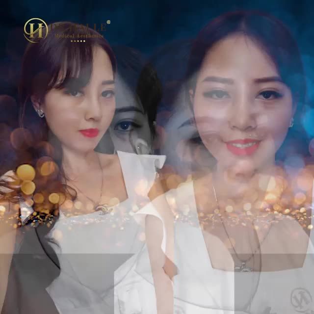 NÂNG MŨI tại Dr.Hải Lê - ĐẸP VÀ HƠN THẾ NỮA!