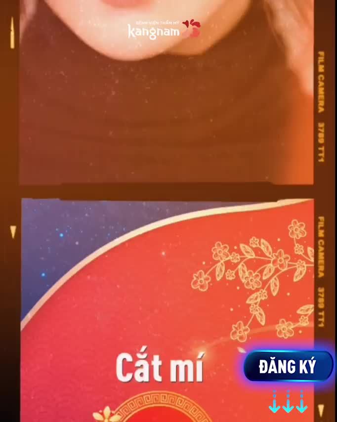 Tết THÊM ƯU ĐÃI  Cắt Mí GIÁ TỐT NHẤT NĂM