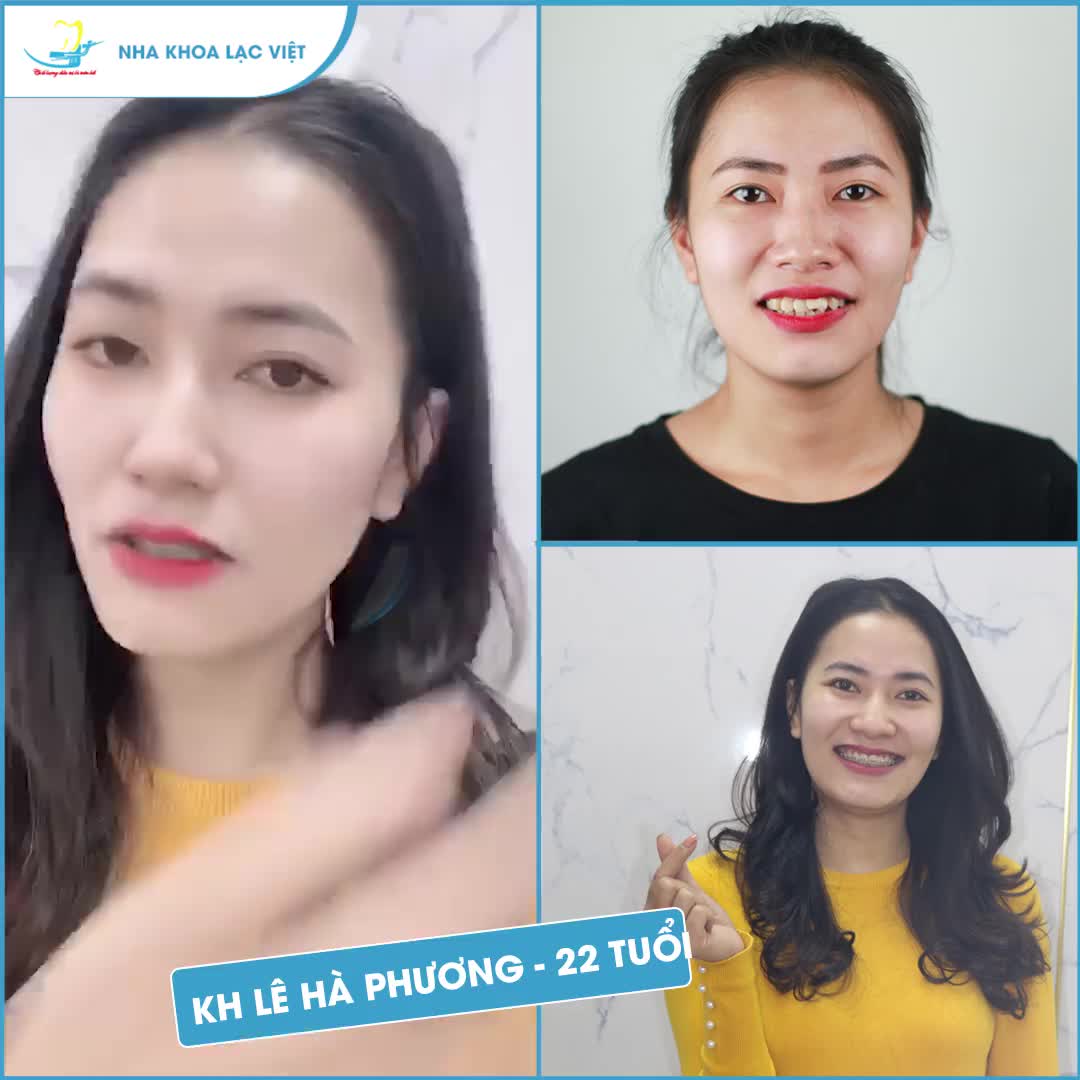 Chỉ cần kiên trì, bạn sẽ nhận được nụ cười như mong muốn. Thế này có được gọi TUYỆT VỜI không ạ!