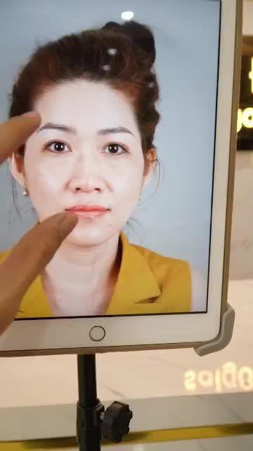 MŨI CẤU TRÚC ĐẸP "XỊN SÒ" SAU 7 NGÀY NÂNG MŨI TẠI DR.HOẠT
