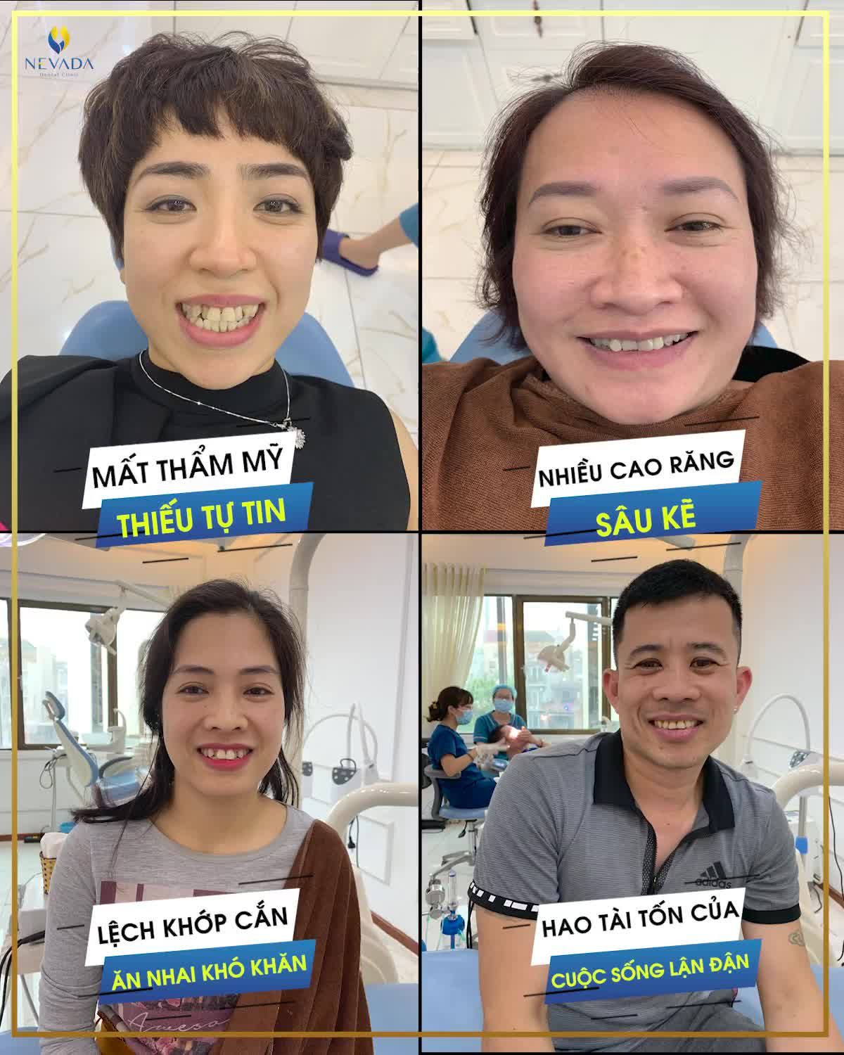 RĂNG KHẤP KHỂNH - XỈN MÀU - SỨT MẺ KHIẾN BẠN MẤT TỰ TIN