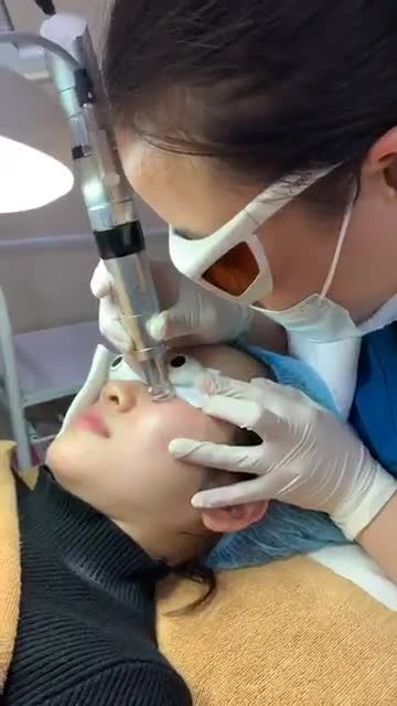 Điều trị tàn nhang với công nghệ Laser siêu hót