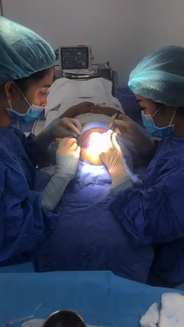 Cấy tóc tự thân 1500 nang tóc có ngay mái tóc dày , đẹp . Giải quyết ngay những nổi lo Hói đầu , rụng tóc .