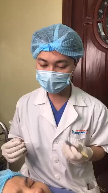 Nếp mí ngay SAU CẮT CHỈ sẽ như nào?
