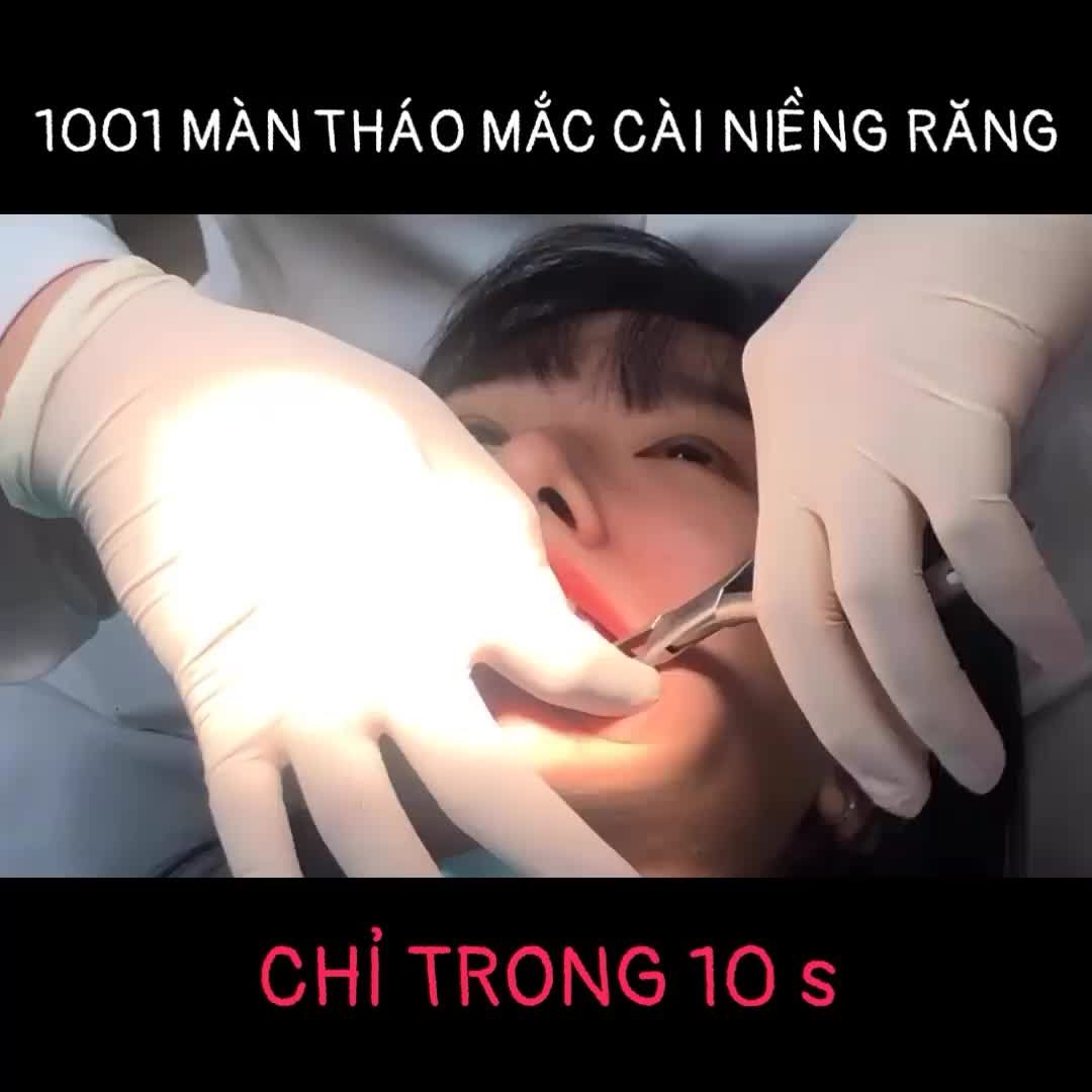 1001 MÀN THÁO MẮC CÀI NIỀNG RĂNG NHANH NHƯ CHỚP NHA KHOA DR HUNG