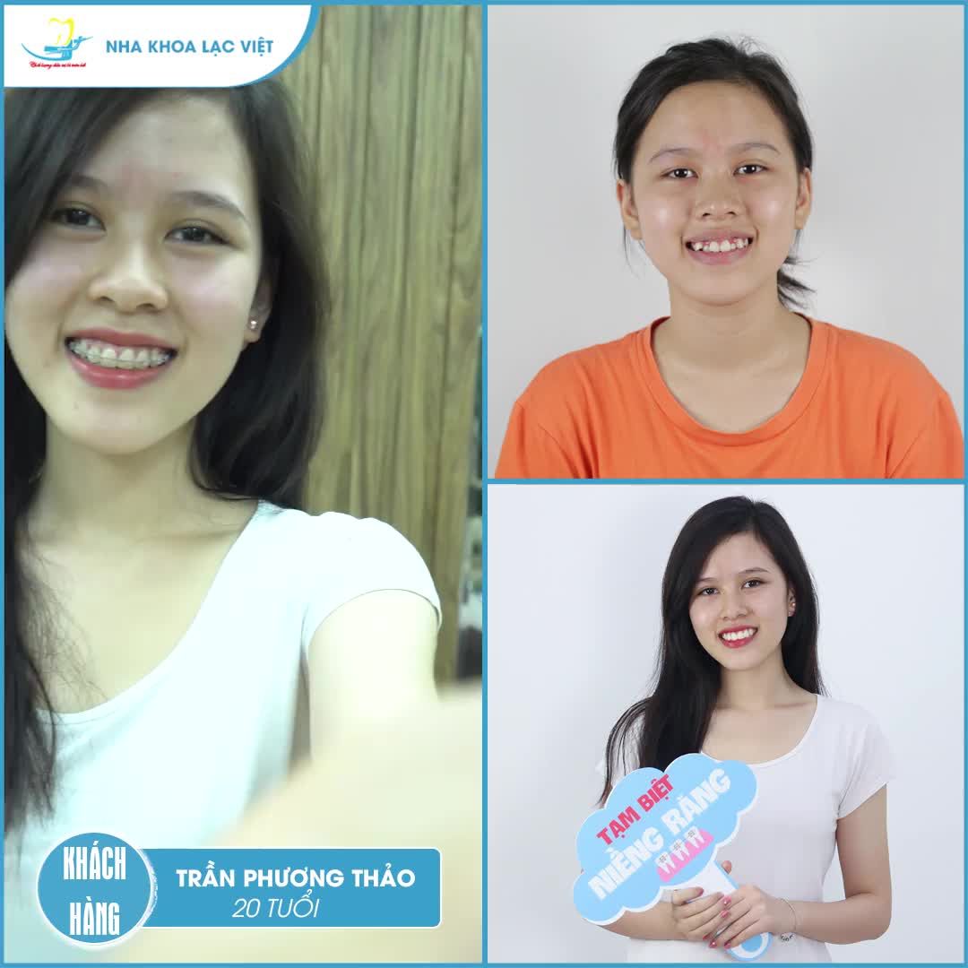 Case tháo mắc cài thứ 5 trong ngày cuối cùng của năm 2019 – MÓN QUÀ NĂM MỚI LẠC VIỆT DÀNH TẶNG BẠN