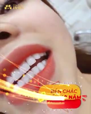 Duy nhất trong tháng 1 chỉ có tại Nha khoa Delia - Thẩm mỹ răng sứ SALE OFF 70%