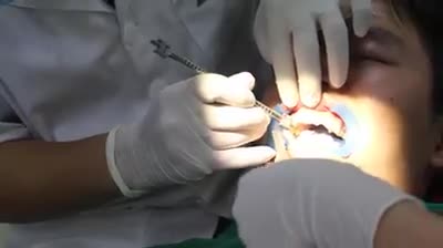 Case gắn mắc cài pha lê cho bệnh nhân N. Đ. H - 17 tuổi ở Hà Đông, Hà Nội.
