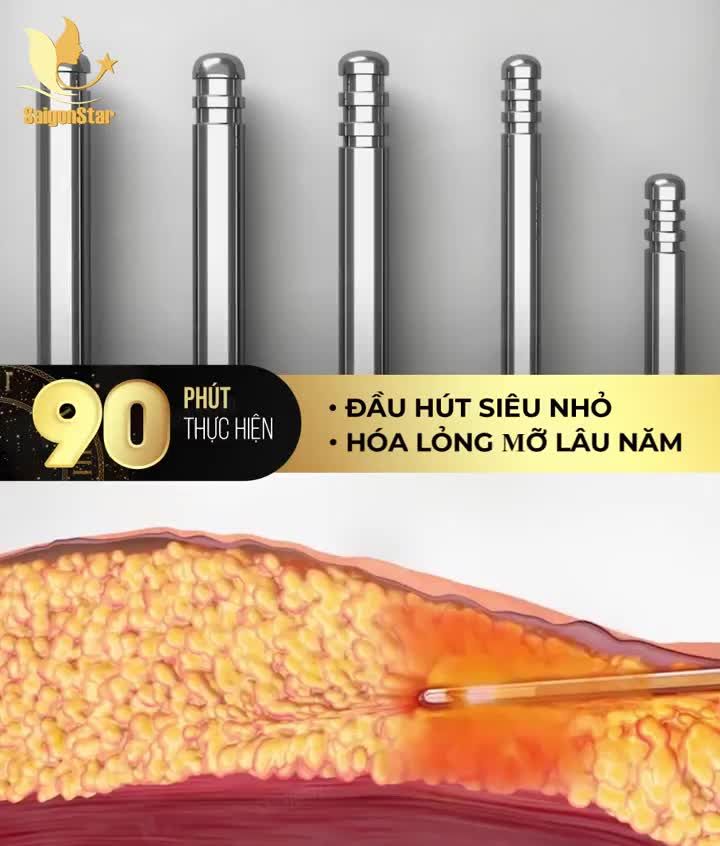 XUÂN CANH TÝ - DÁNG THON NHƯ Ý