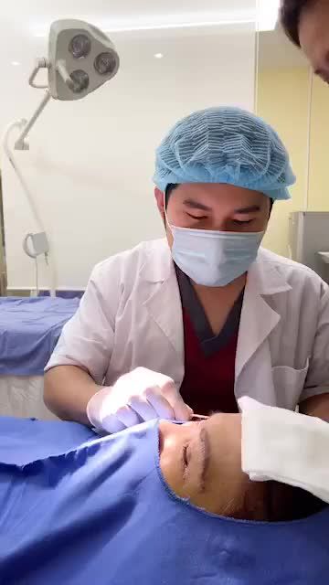 Cắt chỉ NÂNG CUNG MÀY Nâng cơ - Trẻ hóa mắt
