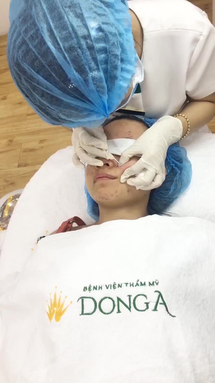 Tình trạng mụn viêm, mụn ẩn đã cải thiện rõ rệt sau 2 buổi điều trị mụn