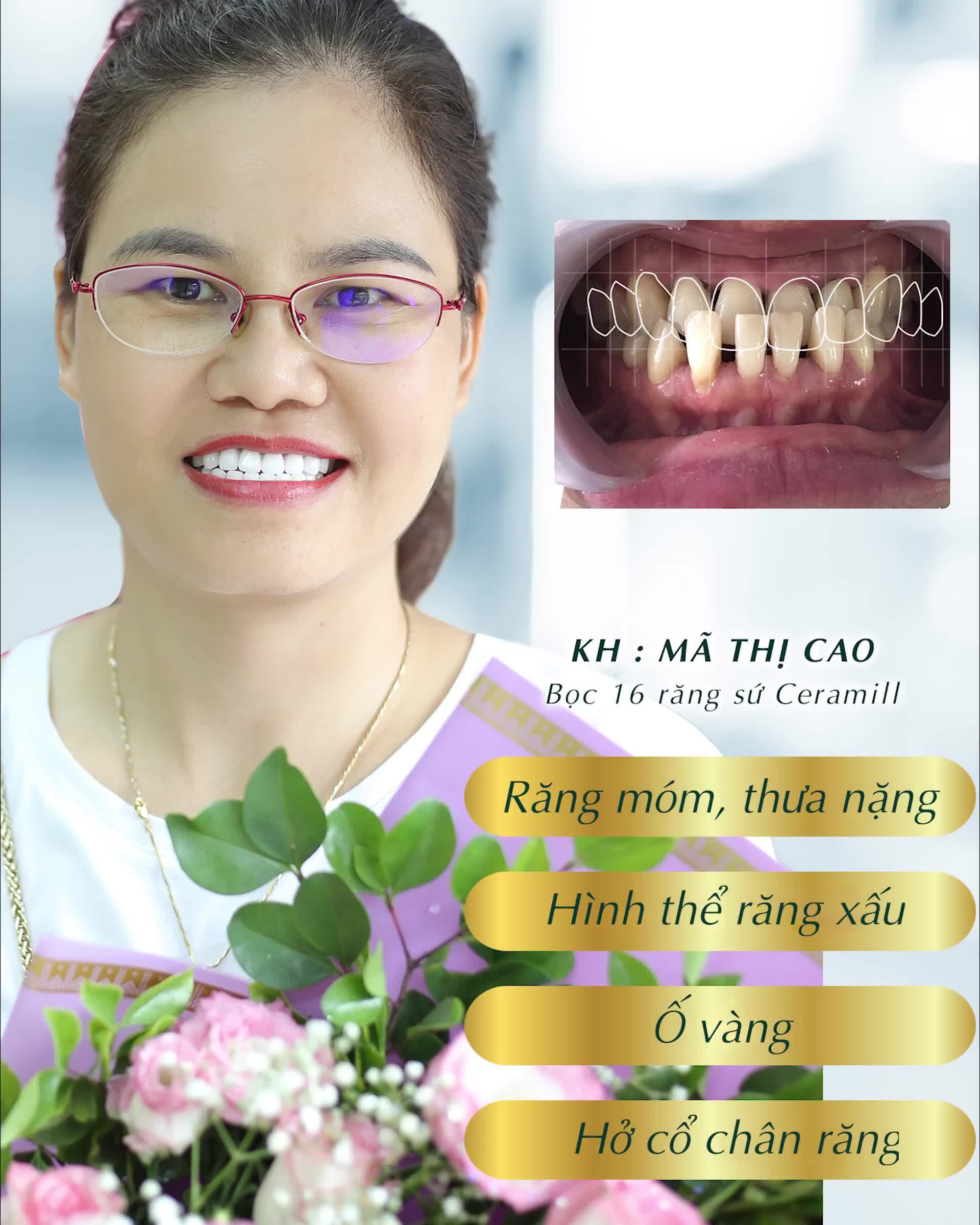 NỤ CƯỜI NHƯ Ý – ĐÓN XUÂN CANH TÝ